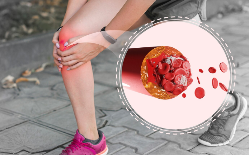 Dầu nhuyễn thể giảm tình trạng đau xương khớp